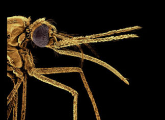 HEALTH ARTICLE (DISTRESS) BY DR. YEMI SANUSI